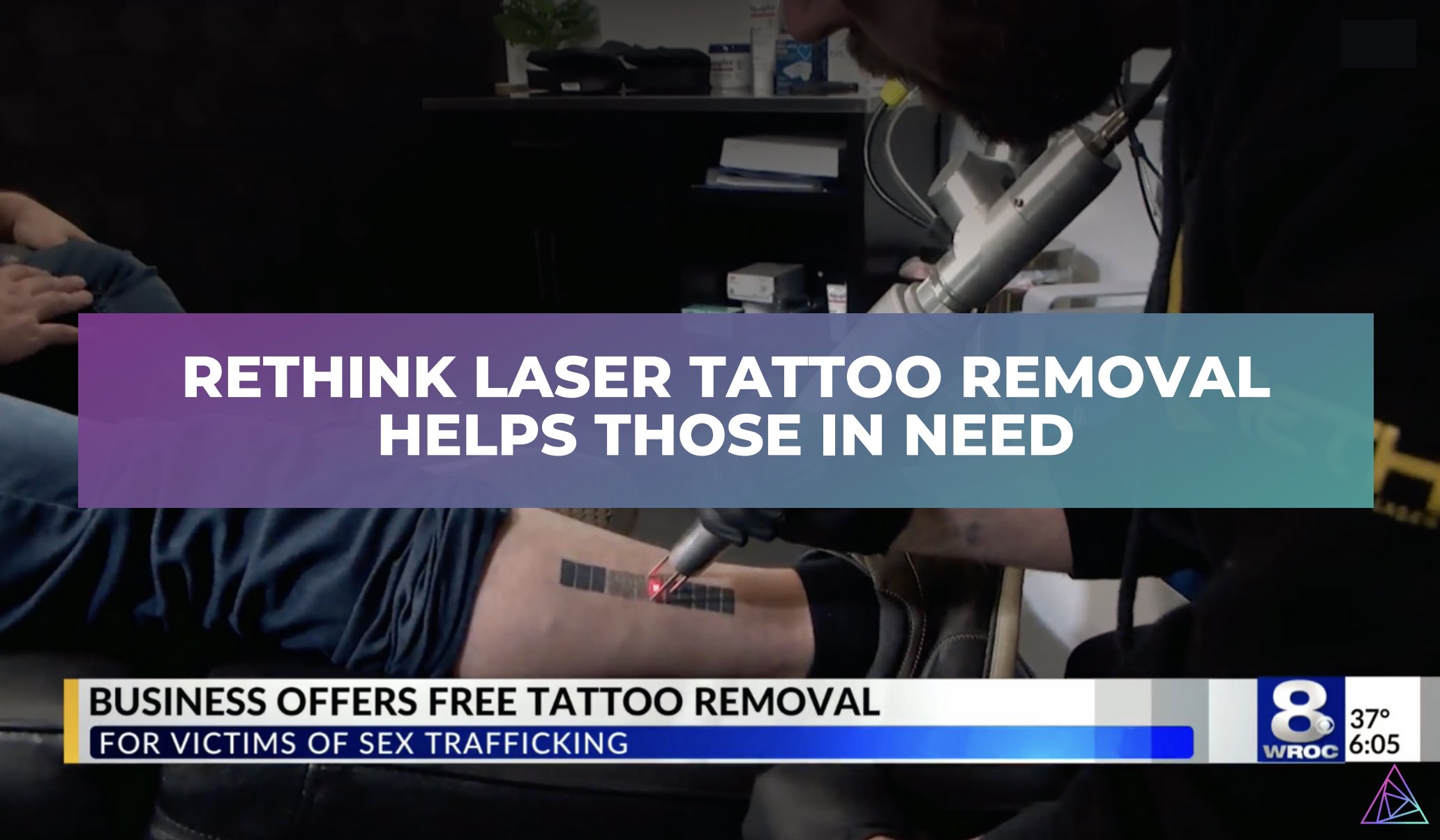 Aggregate 51+ tattoo removal rochester ny in.cdgdbentre
